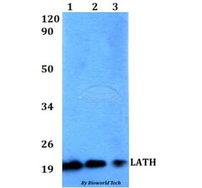 Anti-LATH Antibody from Bioworld Technology (BS60520) - Antibodies.com
