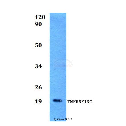 Anti-TNFRSF13C Antibody from Bioworld Technology (BS60522) - Antibodies.com