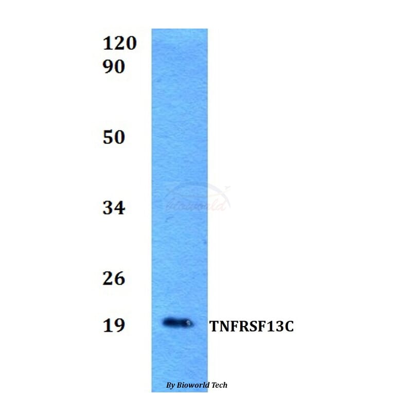 Anti-TNFRSF13C Antibody from Bioworld Technology (BS60522) - Antibodies.com