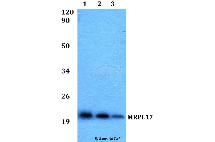 Anti-MRPL17 Antibody from Bioworld Technology (BS60524) - Antibodies.com