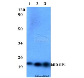 Anti-MID1IP1 Antibody from Bioworld Technology (BS60526) - Antibodies.com