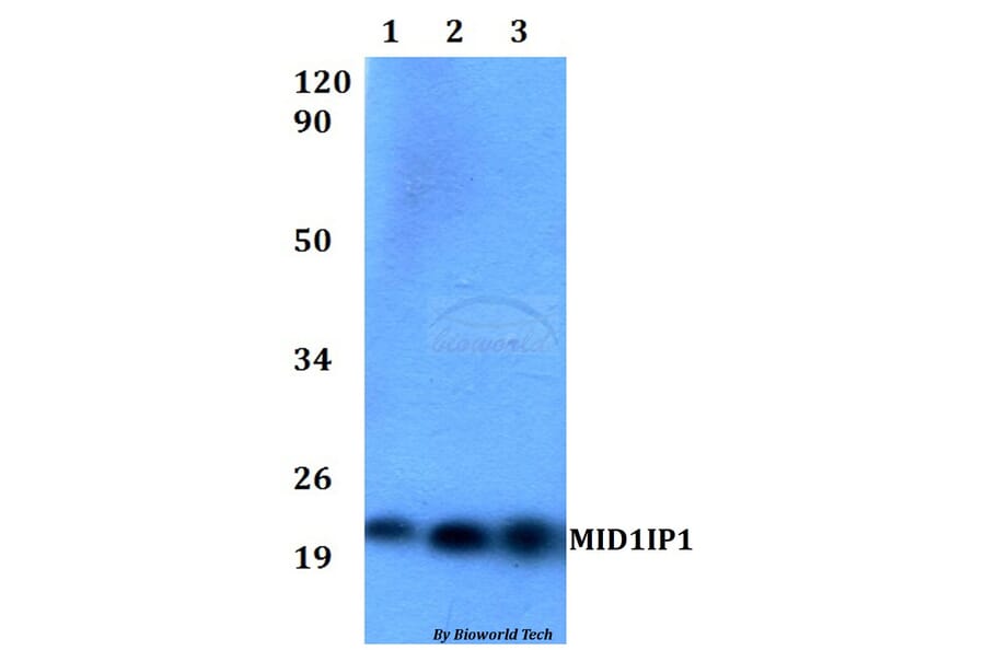 Anti-MID1IP1 Antibody from Bioworld Technology (BS60526) - Antibodies.com