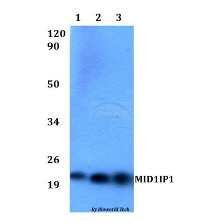 Anti-MID1IP1 Antibody from Bioworld Technology (BS60526) - Antibodies.com