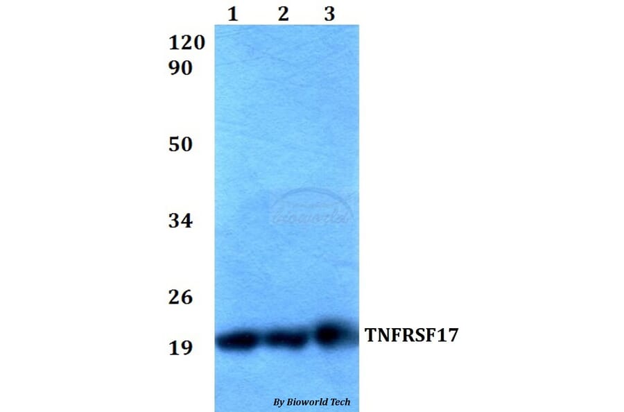 Anti-TNFRSF17 Antibody from Bioworld Technology (BS60527) - Antibodies.com