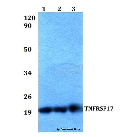 Anti-TNFRSF17 Antibody from Bioworld Technology (BS60527) - Antibodies.com