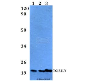 Anti-TGIF2LY Antibody from Bioworld Technology (BS60528) - Antibodies.com