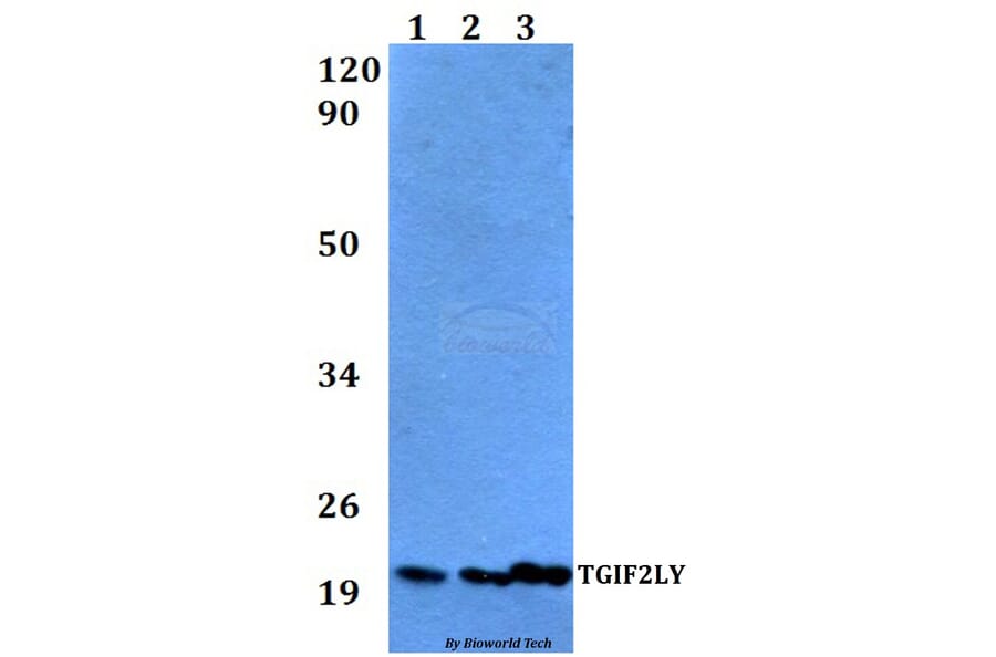 Anti-TGIF2LY Antibody from Bioworld Technology (BS60528) - Antibodies.com