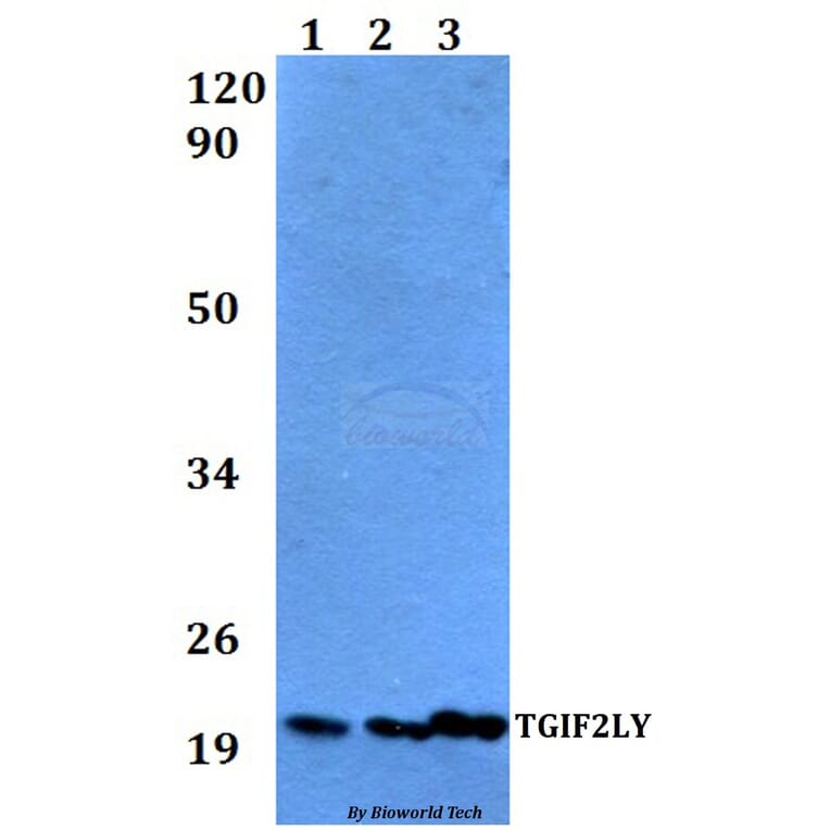 Anti-TGIF2LY Antibody from Bioworld Technology (BS60528) - Antibodies.com