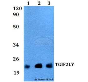 Anti-TGIF2LY Antibody from Bioworld Technology (BS60531) - Antibodies.com