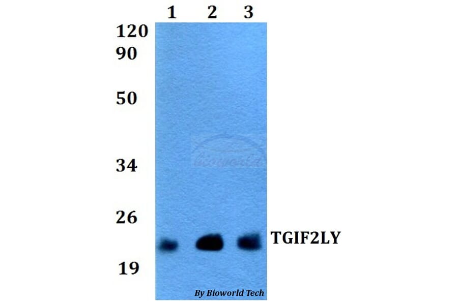 Anti-TGIF2LY Antibody from Bioworld Technology (BS60531) - Antibodies.com