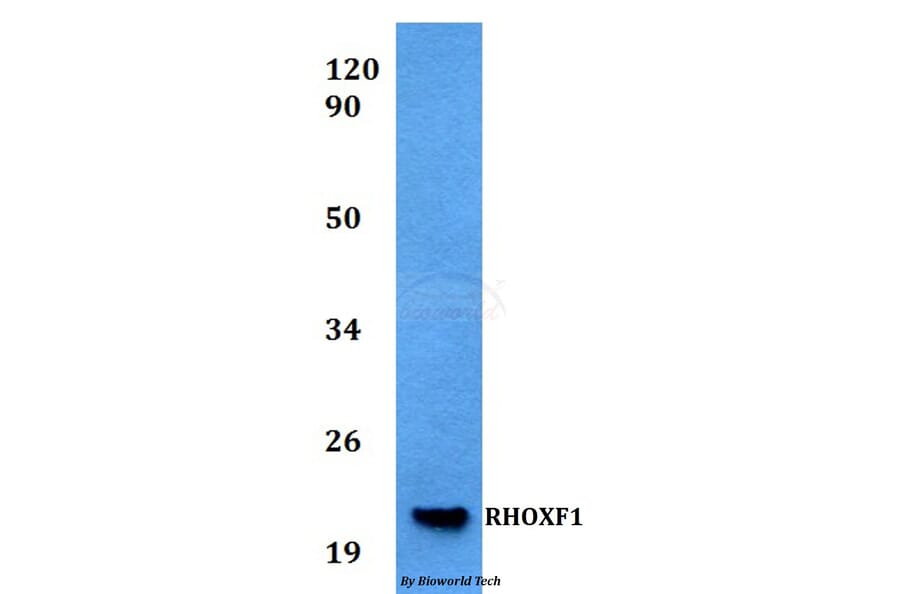 Anti-RHOXF1 Antibody from Bioworld Technology (BS60532) - Antibodies.com
