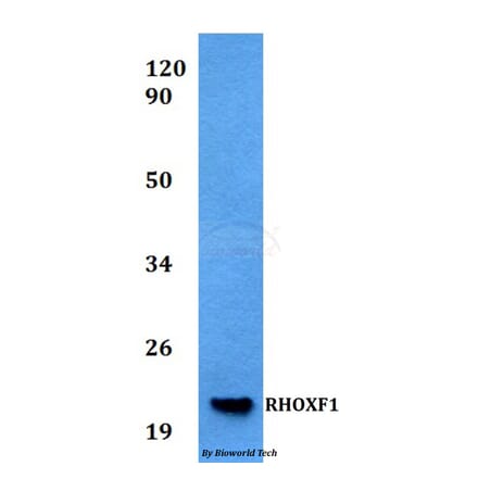 Anti-RHOXF1 Antibody from Bioworld Technology (BS60532) - Antibodies.com