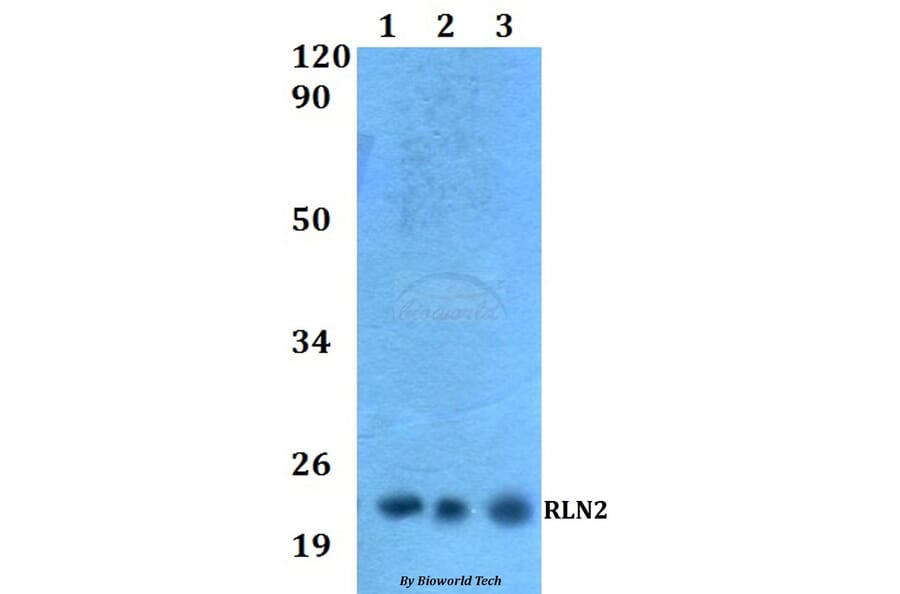 Anti-RLN2 Antibody from Bioworld Technology (BS60533) - Antibodies.com