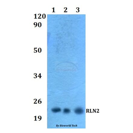 Anti-RLN2 Antibody from Bioworld Technology (BS60533) - Antibodies.com