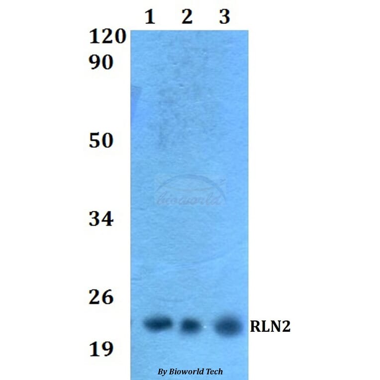 Anti-RLN2 Antibody from Bioworld Technology (BS60533) - Antibodies.com