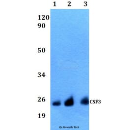 Anti-CSF3 Antibody from Bioworld Technology (BS60536) - Antibodies.com