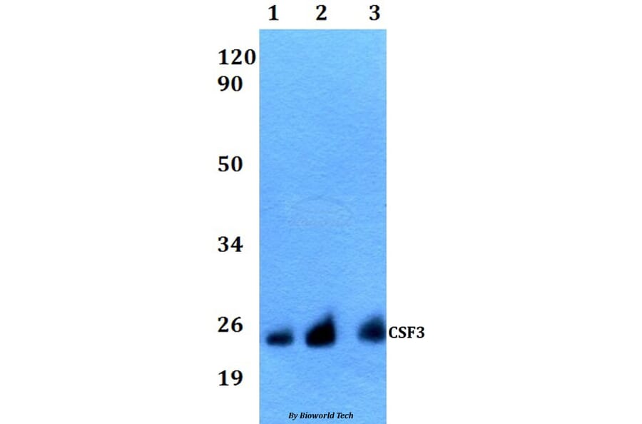 Anti-CSF3 Antibody from Bioworld Technology (BS60536) - Antibodies.com