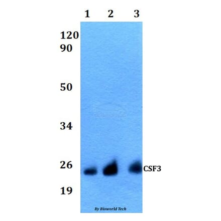 Anti-CSF3 Antibody from Bioworld Technology (BS60536) - Antibodies.com