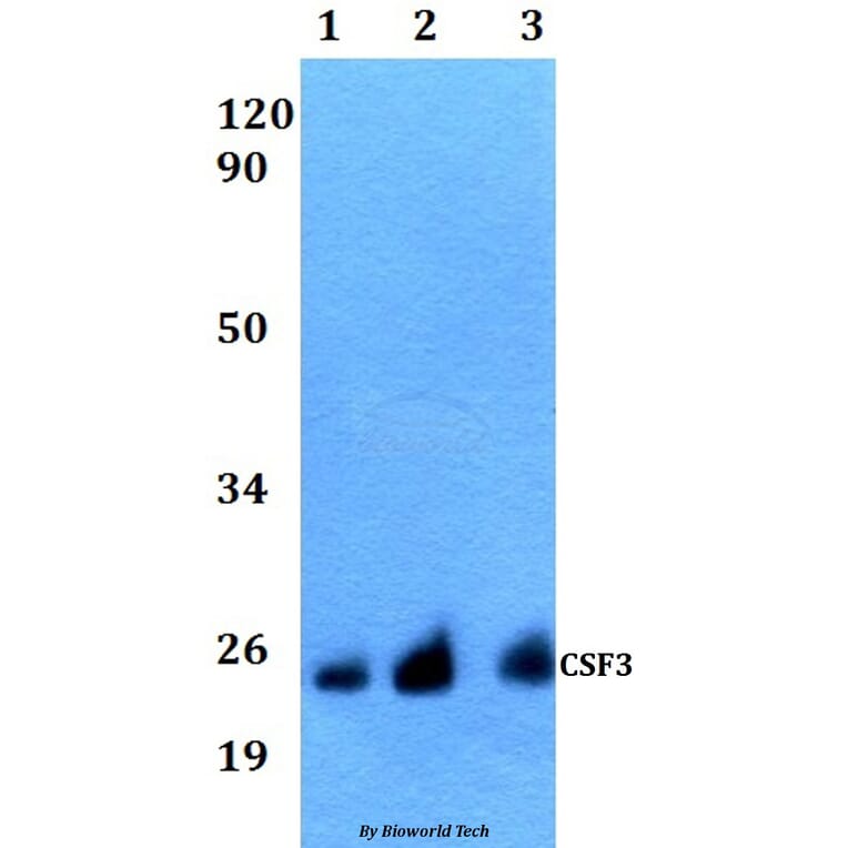 Anti-CSF3 Antibody from Bioworld Technology (BS60536) - Antibodies.com