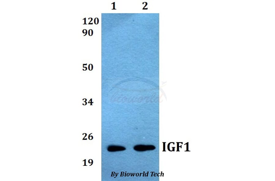 Anti-IGF1 Antibody from Bioworld Technology (BS60538) - Antibodies.com