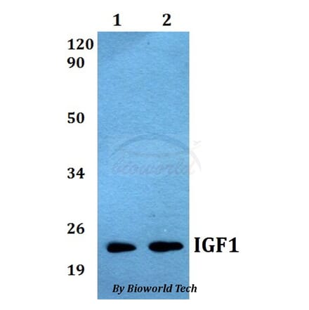 Anti-IGF1 Antibody from Bioworld Technology (BS60538) - Antibodies.com