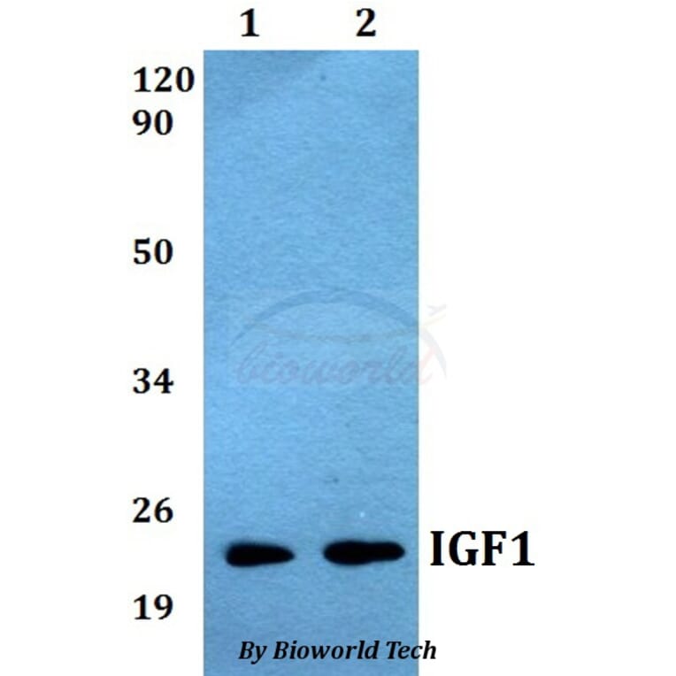 Anti-IGF1 Antibody from Bioworld Technology (BS60538) - Antibodies.com