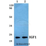 Anti-IGF1 Antibody from Bioworld Technology (BS60538) - Antibodies.com