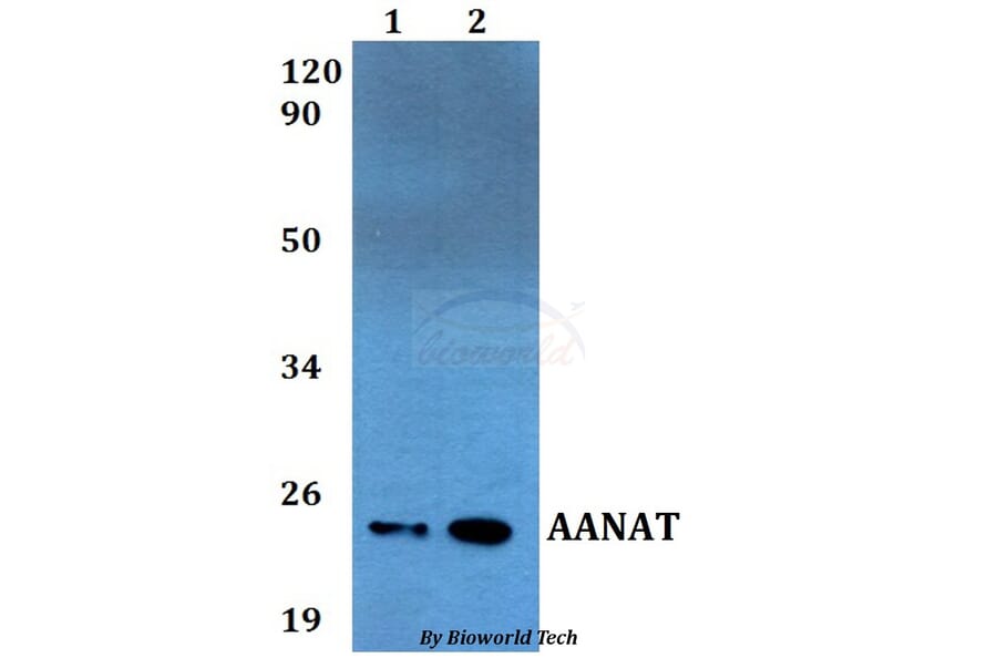 Anti-AANAT Antibody from Bioworld Technology (BS60541) - Antibodies.com