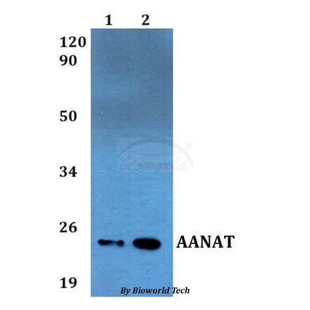 Anti-AANAT Antibody from Bioworld Technology (BS60541) - Antibodies.com
