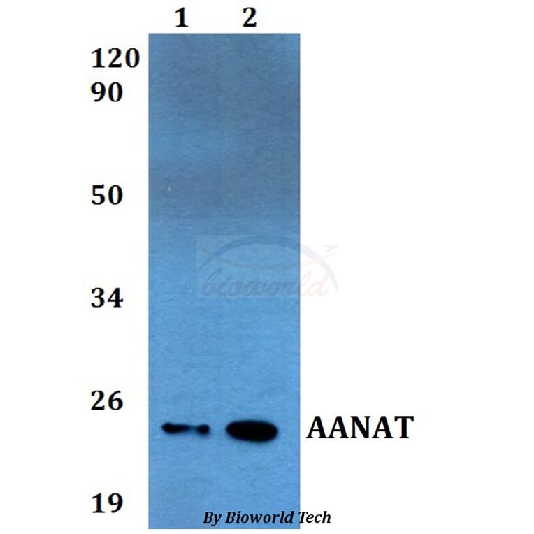 Anti-AANAT Antibody from Bioworld Technology (BS60541) - Antibodies.com