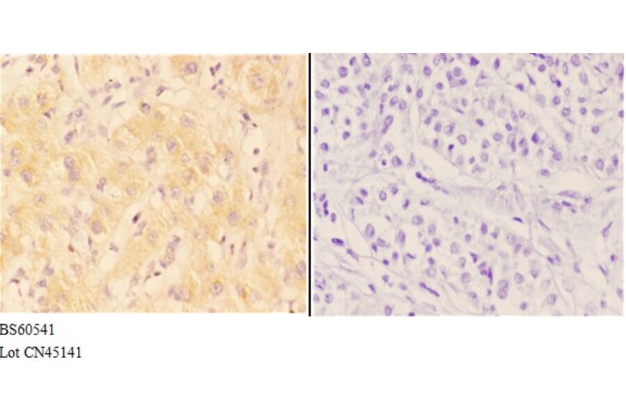 Anti-AANAT Antibody from Bioworld Technology (BS60541) - Antibodies.com