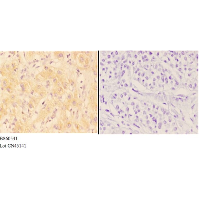 Anti-AANAT Antibody from Bioworld Technology (BS60541) - Antibodies.com