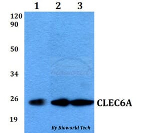 Anti-CLEC6A Antibody from Bioworld Technology (BS60545) - Antibodies.com