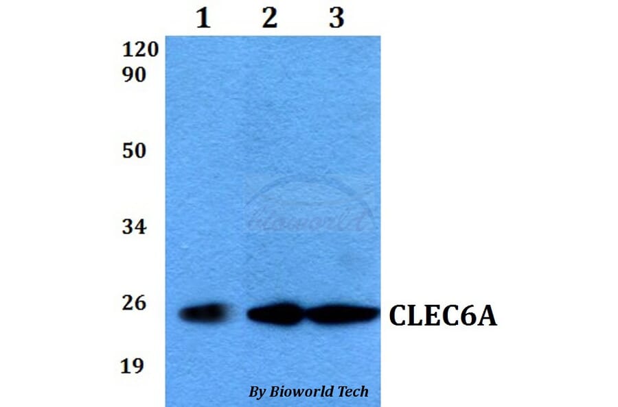 Anti-CLEC6A Antibody from Bioworld Technology (BS60545) - Antibodies.com