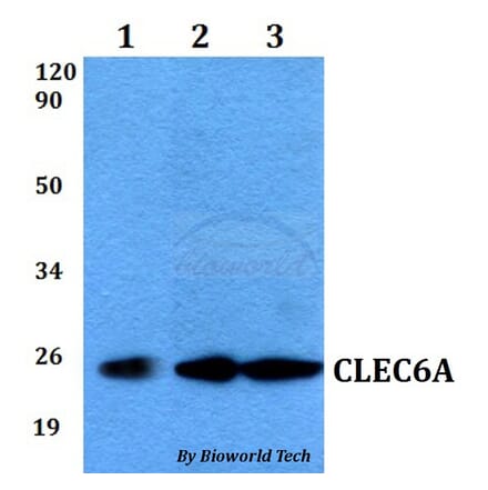 Anti-CLEC6A Antibody from Bioworld Technology (BS60545) - Antibodies.com