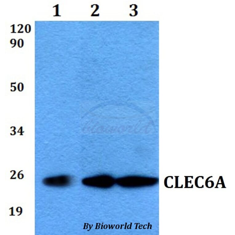 Anti-CLEC6A Antibody from Bioworld Technology (BS60545) - Antibodies.com