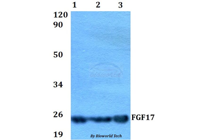 Anti-FGF17 Antibody from Bioworld Technology (BS60548) - Antibodies.com