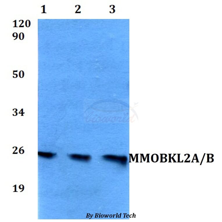 Anti-MMOBKL2A/B Antibody from Bioworld Technology (BS60549) - Antibodies.com