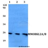 Anti-MMOBKL2A/B Antibody from Bioworld Technology (BS60549) - Antibodies.com