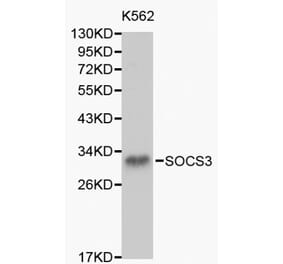 Anti-SOCS3 Antibody from Bioworld Technology (BS6055) - Antibodies.com