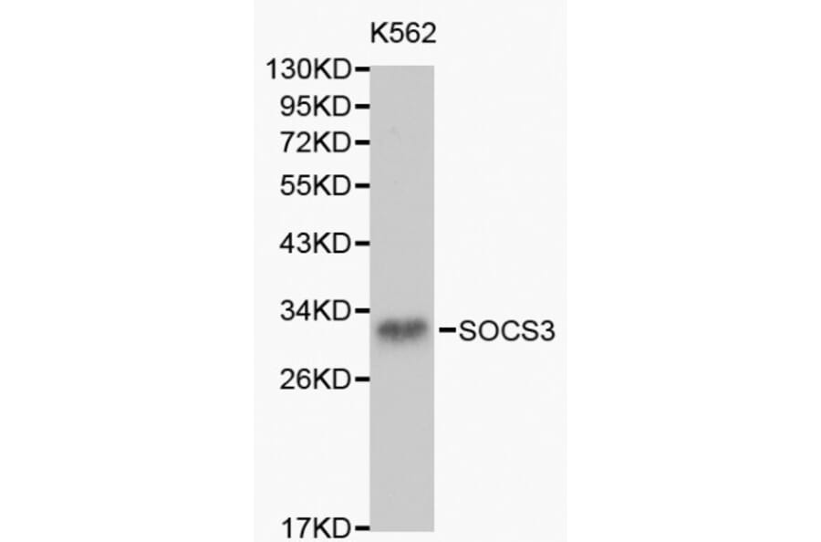 Anti-SOCS3 Antibody from Bioworld Technology (BS6055) - Antibodies.com