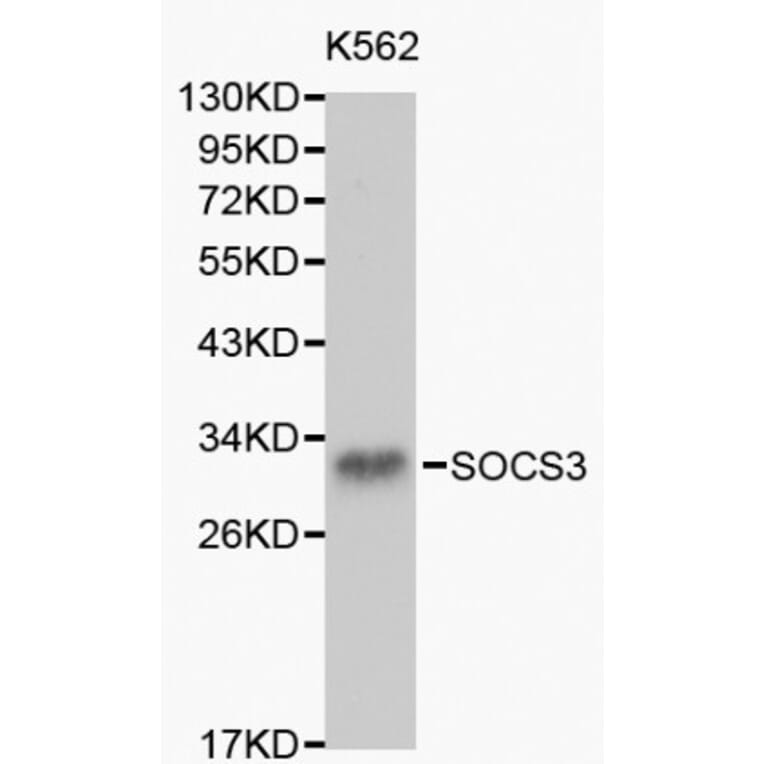 Anti-SOCS3 Antibody from Bioworld Technology (BS6055) - Antibodies.com