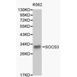 Anti-SOCS3 Antibody from Bioworld Technology (BS6055) - Antibodies.com