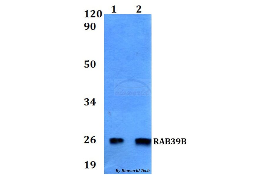 Anti-RAB39B Antibody from Bioworld Technology (BS60551) - Antibodies.com