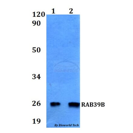 Anti-RAB39B Antibody from Bioworld Technology (BS60551) - Antibodies.com