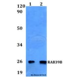 Anti-RAB39B Antibody from Bioworld Technology (BS60551) - Antibodies.com