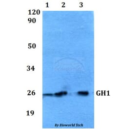 Anti-GH1 Antibody from Bioworld Technology (BS60553) - Antibodies.com