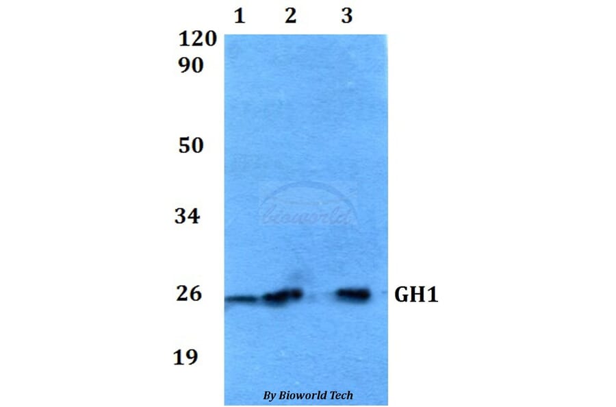 Anti-GH1 Antibody from Bioworld Technology (BS60553) - Antibodies.com