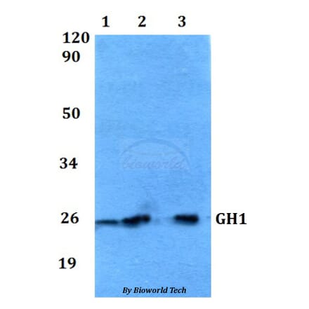 Anti-GH1 Antibody from Bioworld Technology (BS60553) - Antibodies.com