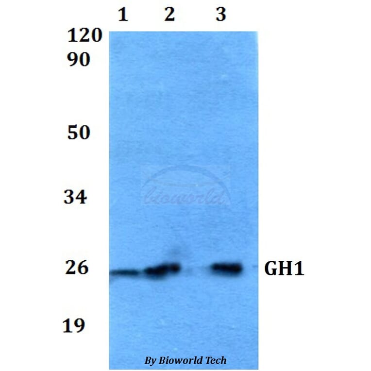 Anti-GH1 Antibody from Bioworld Technology (BS60553) - Antibodies.com